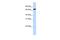 Histidine Ammonia-Lyase antibody, PA5-42754, Invitrogen Antibodies, Western Blot image 