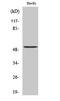 Tubulin alpha-3C/D chain antibody, A17842, Boster Biological Technology, Western Blot image 