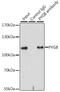 Glycogen Phosphorylase B antibody, GTX64469, GeneTex, Immunoprecipitation image 