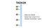 Transcriptional Adaptor 2A antibody, 25-406, ProSci, Western Blot image 