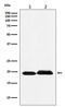 Serine And Arginine Rich Splicing Factor 3 antibody, M03127-1, Boster Biological Technology, Western Blot image 