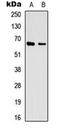 Eukaryotic Translation Initiation Factor 3 Subunit L antibody, orb256511, Biorbyt, Western Blot image 