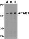 TGF-Beta Activated Kinase 1 (MAP3K7) Binding Protein 1 antibody, TA306187, Origene, Western Blot image 