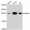 High Mobility Group Box 1 antibody, STJ112785, St John