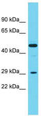 Carboxypeptidase A2 antibody, TA346563, Origene, Western Blot image 