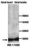 Protein Phosphatase 6 Catalytic Subunit antibody, orb77130, Biorbyt, Western Blot image 