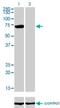 Protein Inhibitor Of Activated STAT 3 antibody, H00010401-M03, Novus Biologicals, Western Blot image 