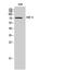 Solute Carrier Family 9 Member A6 antibody, A05023-1, Boster Biological Technology, Western Blot image 