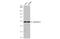 Keratin 8 antibody, GTX112975, GeneTex, Western Blot image 