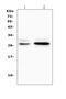 TNF Receptor Superfamily Member 18 antibody, A03125-1, Boster Biological Technology, Western Blot image 