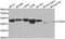 Ataxin 3 antibody, LS-C748055, Lifespan Biosciences, Western Blot image 