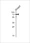 Hyaluronan Synthase 2 antibody, GTX01068, GeneTex, Western Blot image 