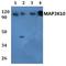 MLK2 antibody, A08285, Boster Biological Technology, Western Blot image 