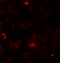 Rho Associated Coiled-Coil Containing Protein Kinase 1 antibody, 6295, ProSci, Immunofluorescence image 