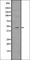 Sp7 Transcription Factor antibody, orb336789, Biorbyt, Western Blot image 