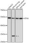 ETS Variant 6 antibody, 16-169, ProSci, Western Blot image 