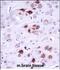 Megakaryocyte-Associated Tyrosine Kinase antibody, PA5-48676, Invitrogen Antibodies, Immunohistochemistry frozen image 