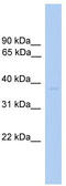 ST6 N-Acetylgalactosaminide Alpha-2,6-Sialyltransferase 6 antibody, TA341922, Origene, Western Blot image 