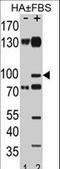 Ephrin type-A receptor 2 antibody, LS-C163608, Lifespan Biosciences, Western Blot image 