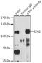 Enhancer Of Zeste 2 Polycomb Repressive Complex 2 Subunit antibody, LS-C748887, Lifespan Biosciences, Immunoprecipitation image 