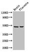 CD177 Molecule antibody, LS-C397770, Lifespan Biosciences, Western Blot image 