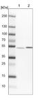 THUMP Domain Containing 2 antibody, NBP1-92504, Novus Biologicals, Western Blot image 