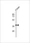 SH3 Domain Containing GRB2 Like 3, Endophilin A3 antibody, M09836, Boster Biological Technology, Western Blot image 