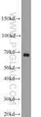 SAM And HD Domain Containing Deoxynucleoside Triphosphate Triphosphohydrolase 1 antibody, 12586-1-AP, Proteintech Group, Western Blot image 