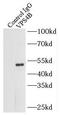 Vacuolar Protein Sorting 4 Homolog B antibody, FNab09446, FineTest, Immunoprecipitation image 