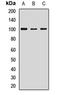 Leucine Rich Repeat Containing G Protein-Coupled Receptor 5 antibody, LS-C668403, Lifespan Biosciences, Western Blot image 