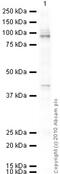 Glutamate Metabotropic Receptor 2 antibody, ab15672, Abcam, Western Blot image 