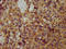 WAP Four-Disulfide Core Domain 2 antibody, LS-C211882, Lifespan Biosciences, Immunohistochemistry paraffin image 