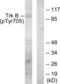 Neurotrophic Receptor Tyrosine Kinase 2 antibody, LS-C199687, Lifespan Biosciences, Western Blot image 