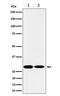 Synaptosome Associated Protein 29 antibody, M05318, Boster Biological Technology, Western Blot image 