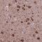 Protein Inhibitor Of Activated STAT 3 antibody, NBP2-48503, Novus Biologicals, Immunohistochemistry paraffin image 