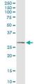 Interferon Alpha 2 antibody, H00003440-M06, Novus Biologicals, Western Blot image 