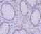 KH-Type Splicing Regulatory Protein antibody, A02770-1, Boster Biological Technology, Immunohistochemistry frozen image 