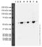 Parkin RBR E3 Ubiquitin Protein Ligase antibody, ab15954, Abcam, Western Blot image 