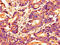 Histone Deacetylase 10 antibody, CSB-PA010236LA01HU, Cusabio, Immunohistochemistry paraffin image 