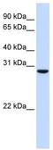 Tubulin Polyglutamylase Complex Subunit 2 antibody, TA333815, Origene, Western Blot image 