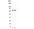 Purinergic Receptor P2X 4 antibody, R31242, NSJ Bioreagents, Western Blot image 