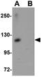 ATPase Phospholipid Transporting 11A antibody, GTX85170, GeneTex, Western Blot image 