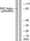 Protein Kinase C Theta antibody, TA312814, Origene, Western Blot image 