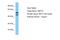 WD Repeat And FYVE Domain Containing 2 antibody, A12831, Boster Biological Technology, Western Blot image 