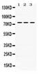 Interleukin 2 Receptor Subunit Beta antibody, PA5-79495, Invitrogen Antibodies, Western Blot image 