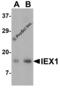 Radiation-inducible immediate-early gene IEX-1 antibody, 4247, ProSci, Western Blot image 