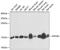 Protein Phosphatase 3 Regulatory Subunit B, Alpha antibody, GTX64517, GeneTex, Western Blot image 