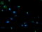 Phosphoglycerate Mutase 2 antibody, LS-C173233, Lifespan Biosciences, Immunofluorescence image 