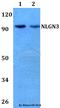 Neuroligin 3 antibody, A04627, Boster Biological Technology, Western Blot image 