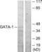 GATA Binding Protein 1 antibody, LS-C118127, Lifespan Biosciences, Western Blot image 